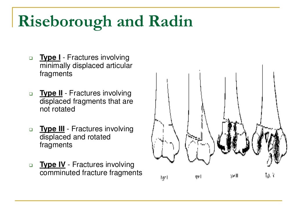 anatomy of elbow & fractures around elbow & surgical options in adults