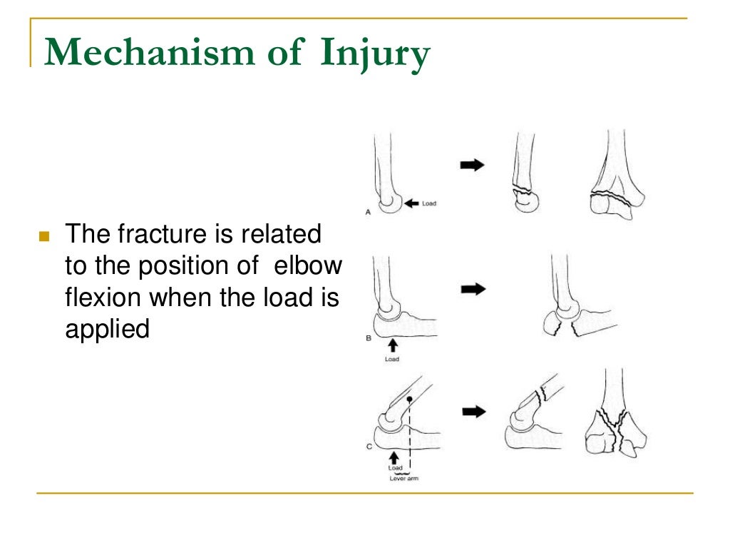anatomy of elbow & fractures around elbow & surgical options in adults