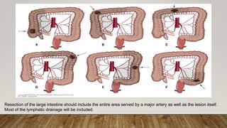 surgical anatomy of large bowel and appendix.pptx