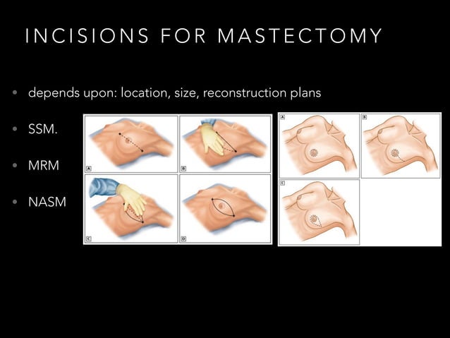 Orr Incision Surgical anatomy of breasts | PDF | Cosmetic Medical Services | Medical ...