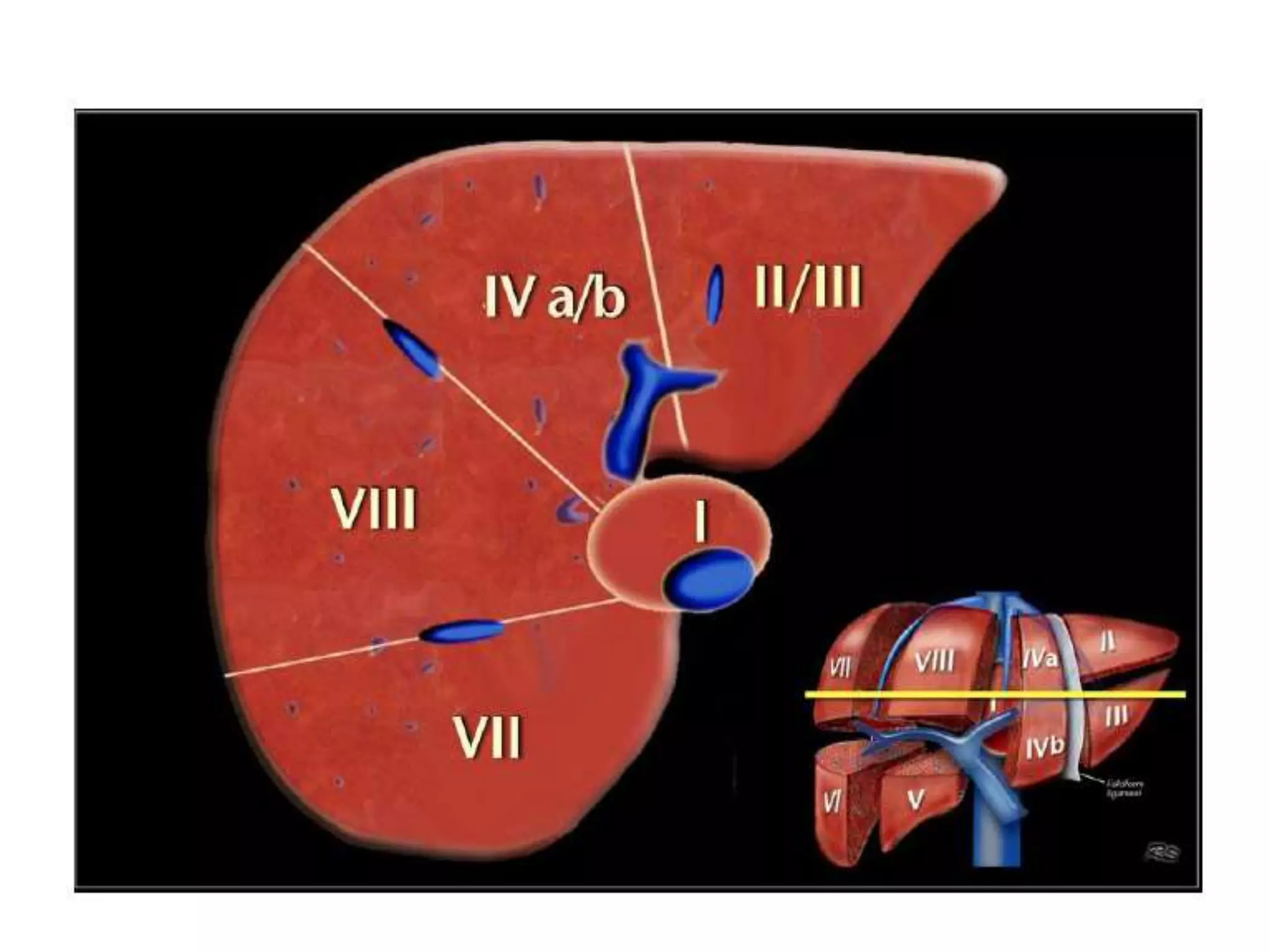 Surgical anatomy of liver | PPTX