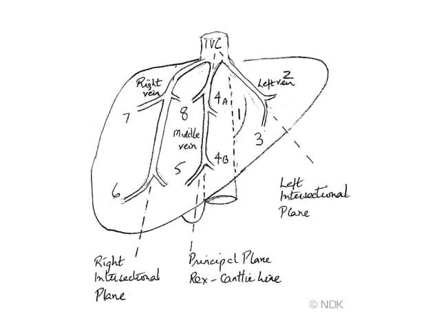 Surgical anatomy of liver | PPTX