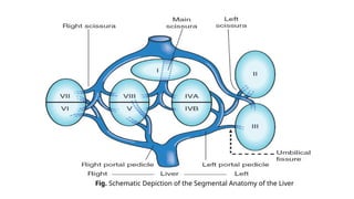 Surgical Anatomy of Liver in detail for undergraduate | PPTX