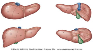 Surgical Anatomy of Liver in detail for undergraduate | PPTX