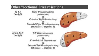 Surgical anatomy of Liver, Concept of liver.pptx
