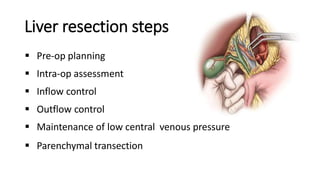 Operating Livers Surgical anatomy of Liver, Concept of liver.pptx