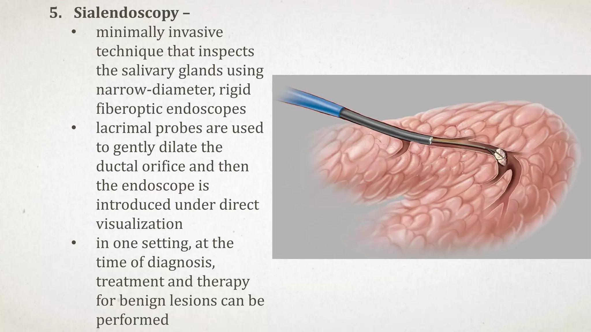 surgical-anatomy-of-major-salivary-glands-pptx