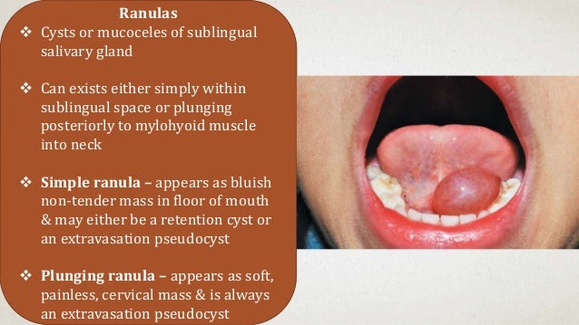 Surgical Anatomy Of Major Salivary Glands