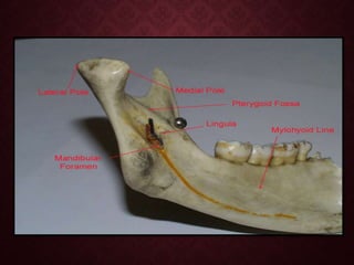 Mandule SURGICAL ANATOMY OF MANDIBLE.pptx