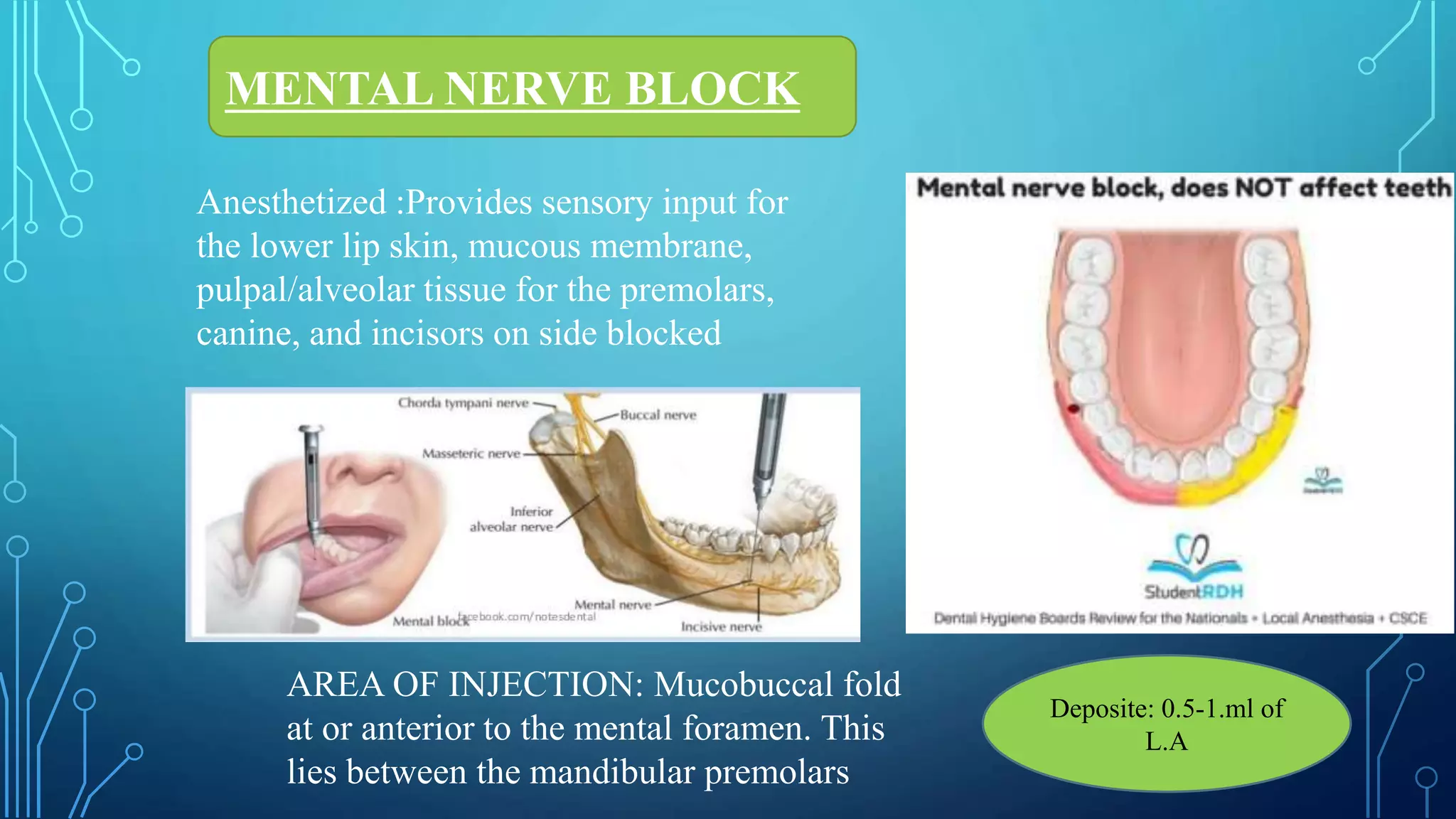 MENTAL NERVE BLOCK
Anesthetized :Provides sensory input for
the lower lip skin, mucous membrane,
pulpal/alveolar tissue for the premolars,
canine, and incisors on side blocked
AREA OF INJECTION: Mucobuccal fold
at or anterior to the mental foramen. This
lies between the mandibular premolars
Deposite: 0.5-1.ml of
L.A
 