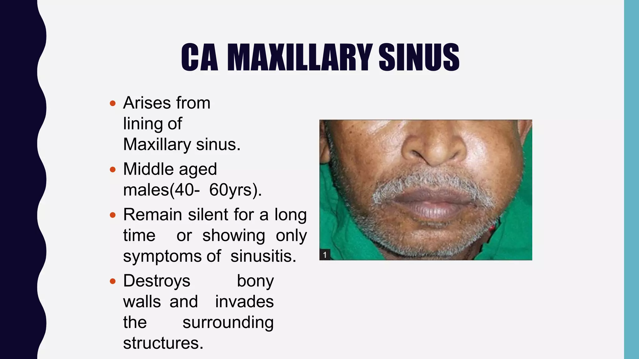 Surgical anatomy of maxillary sinus | PPTX