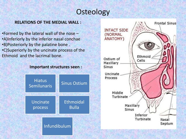 Surgical anatomy of Maxillary Sinus , Lateral wall of nose and Soft ...