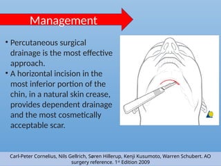 Percutaneous Incision SURGICAL ANATOMY OF MAXILLOFACIAL SPACES | PPTX