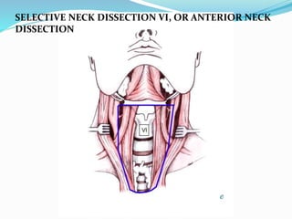 Surgical anatomy of neck | PPTX