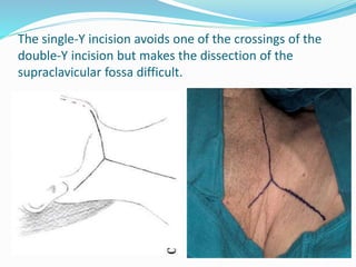 Y Incision Example Surgical anatomy of neck | PPTX