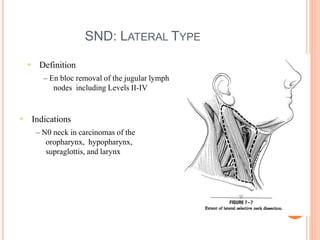 SND: POSTEROLATERAL TYPE
• Definition
– En bloc excision of lymph bearing tissues in Levels II-IV and
additional node grou...