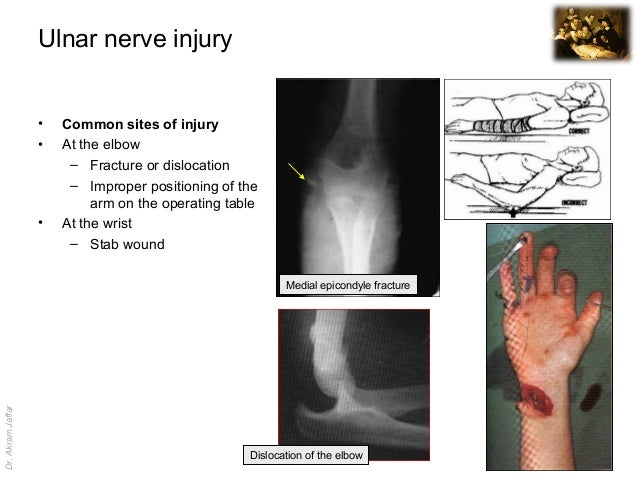 Surgical anatomy of nerve and vascular injuries in the ...