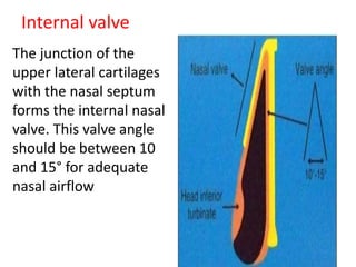 Internal valve
The junction of the
upper lateral cartilages
with the nasal septum
forms the internal nasal
valve. This valve angle
should be between 10
and 15° for adequate
nasal airflow
 
