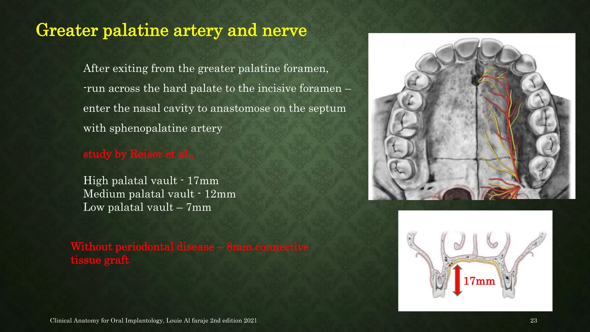 SURGICAL ANATOMY OF ORAL IMPLANTOLOGY.pptx