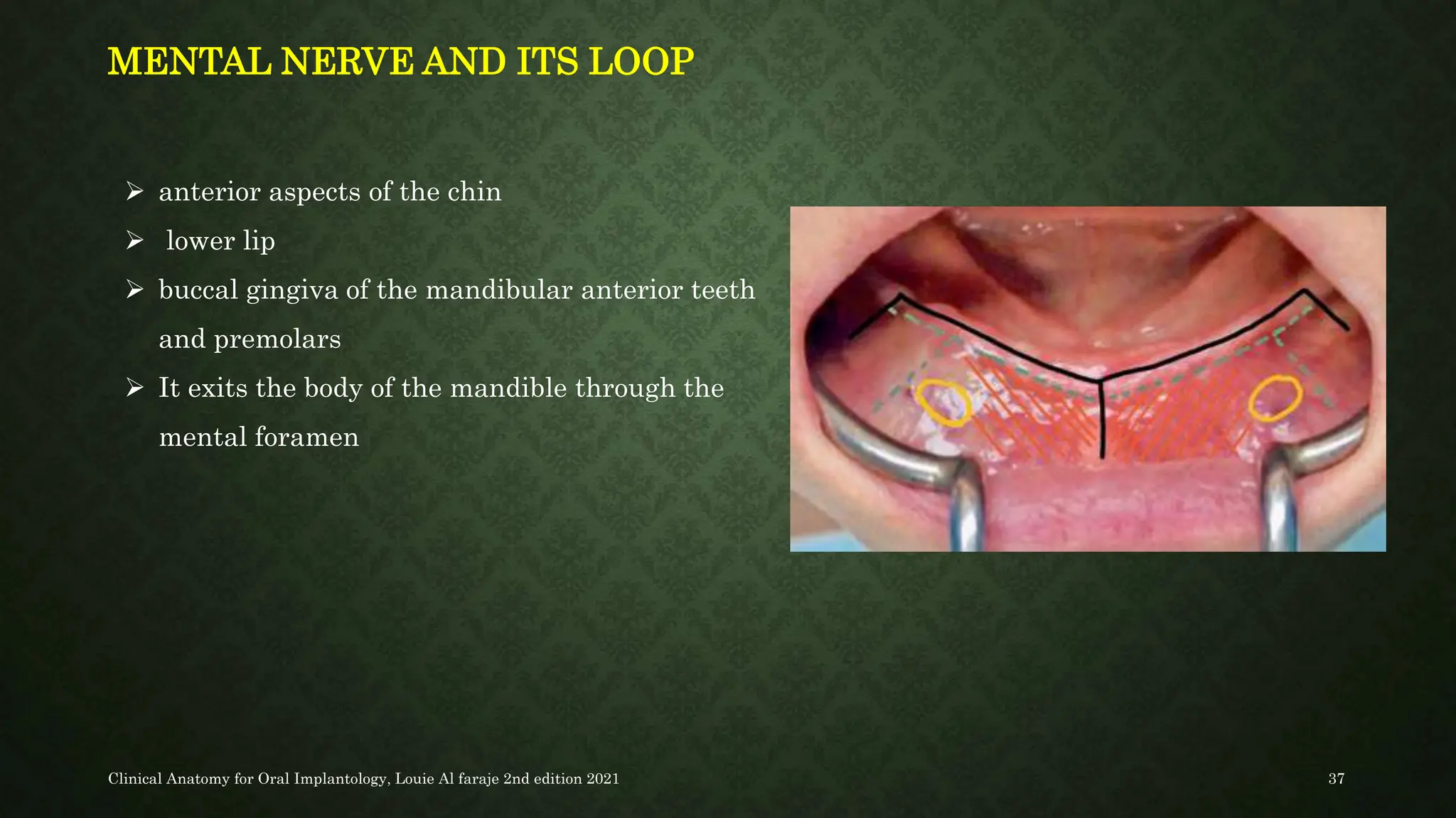 SURGICAL ANATOMY OF ORAL IMPLANTOLOGY.pptx