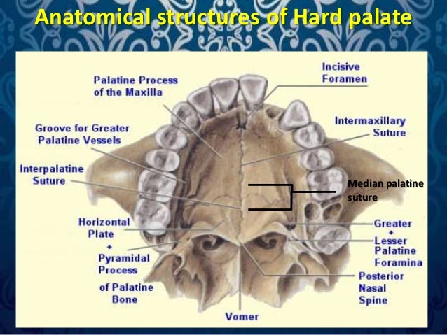 Surgical anatomy of palate by Dr. Amit Suryawanshi .Oral ... roof of mouth diagram 