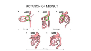 Reverse Rotation Intestine Comprehensive Surgical Anatomy of the Small Intestine: Structure ...