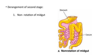 Reverse Rotation Intestine Comprehensive Surgical Anatomy of the Small Intestine: Structure ...