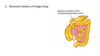 Reverse Rotation Intestine Comprehensive Surgical Anatomy of the Small Intestine: Structure ...