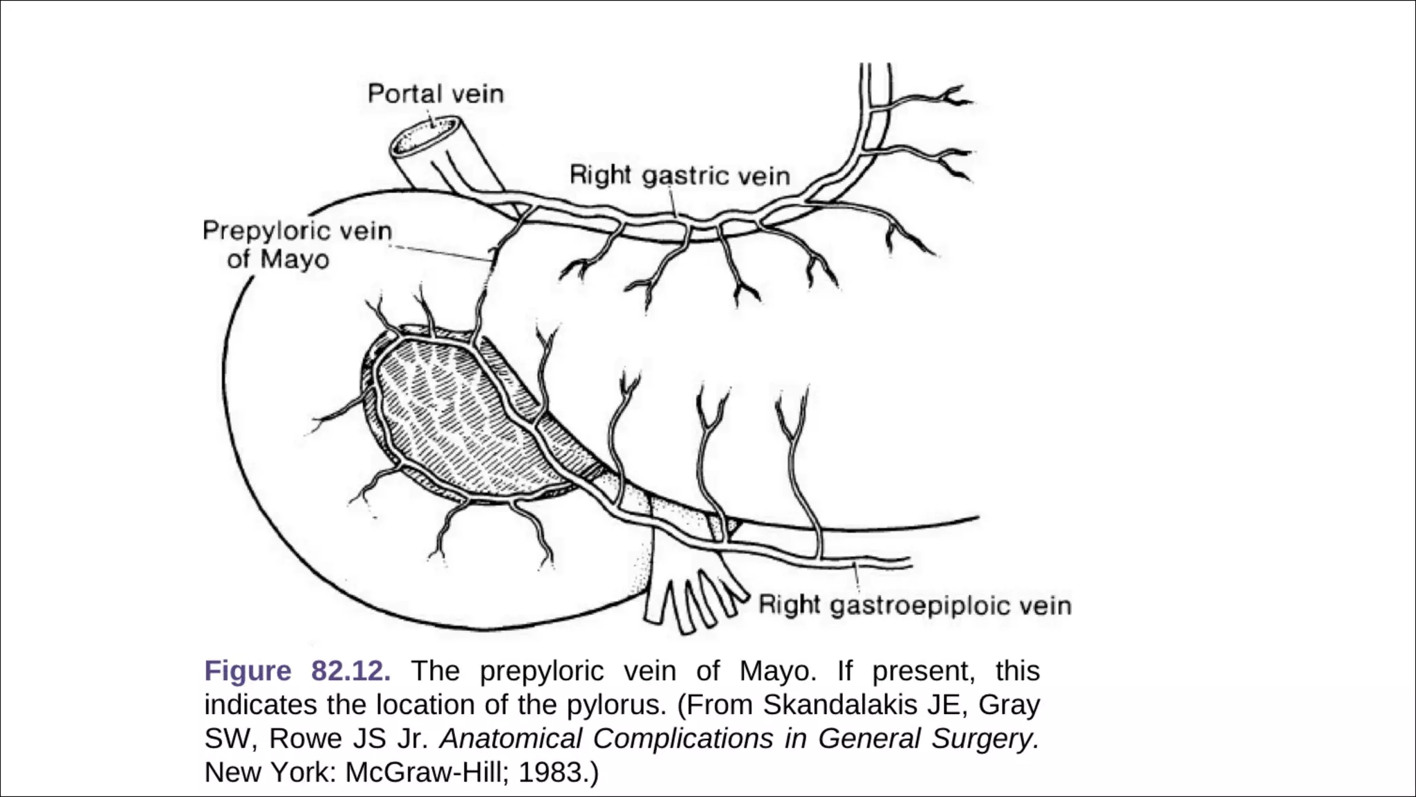 SURGICAL ANATOMY OF STOMACH AND DUODENUM dr. bruhath^final. .pdf