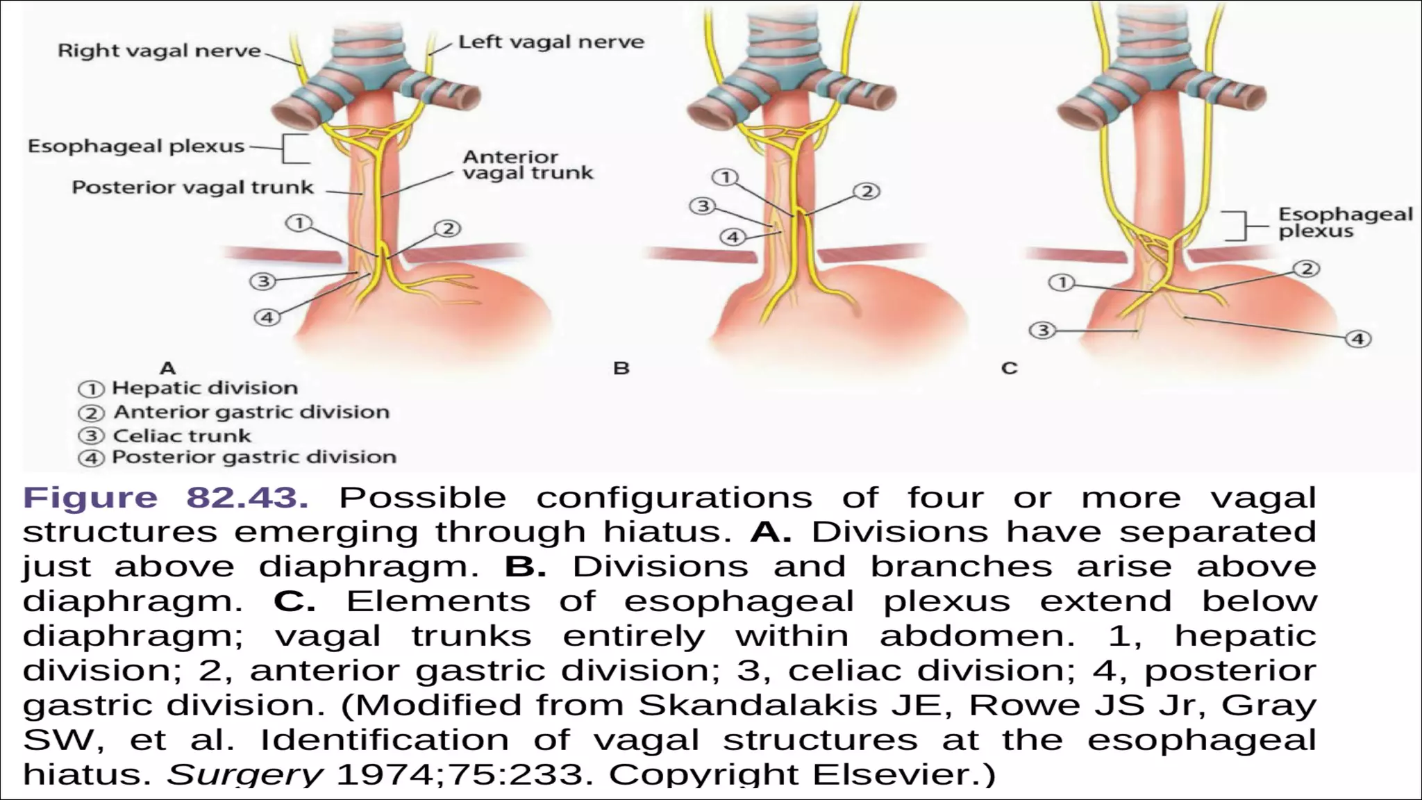 SURGICAL ANATOMY OF STOMACH AND DUODENUM dr. bruhath^final. .pdf