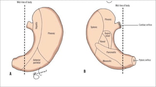 SURGICAL ANATOMY OF STOMACH AND DUODENUM dr. bruhath^final. .pdf