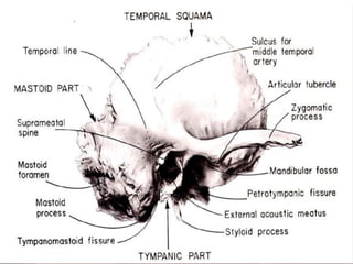 surgical anatomy temporal bone and its apllied importance | PPTX