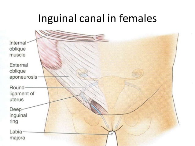 Inguinal canal in female courtesy of https://www.slideshare.net/vernonpashi/surgical-anatomy-of-the-inguinal-canal