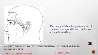Surgical anatomy of tmj | PPTX