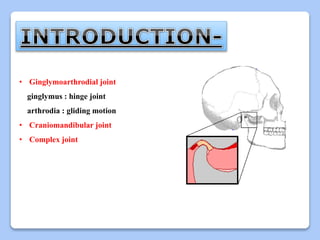 Surgical Anatomy Of TMJ PPTX