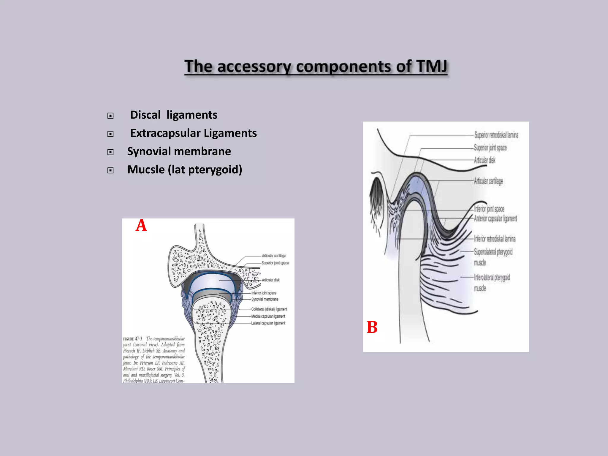 Surgical anatomy of temporomandibular joint | PPTX