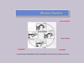 Surgical anatomy of temporomandibular joint | PPTX