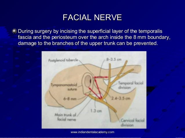 Surgical approaches of TMJ /certified fixed orthodontic ... eyebrow pain diagram 