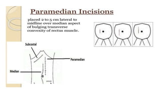 SURGICAL APPROACHES,INCISIONS AND USE OF APPROPRIATE.pptx
