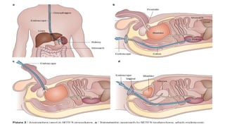 SURGICAL APPROACHES,INCISIONS AND USE OF APPROPRIATE.pptx