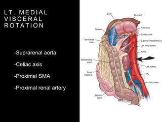 Surgical approaches to abdominal vessels | PPTX