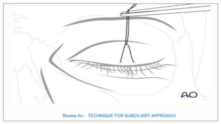 Subciliary Approach Incision surgical approaches to facial skeleton -periorbital.pptx