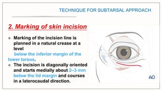 surgical approaches to facial skeleton -periorbital.pptx