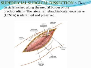 SUPERFICIAL SURGICAL DISSECTION :- Deep
fascia is incised along the medial border of the
brachioradialis. The lateral antebrachial cutaneous nerve
(LCNFA) is identified and preserved.
 