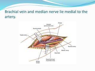 Brachial vein and median nerve lie medial to the
artery.
 