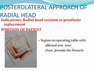 POSTEROLATERAL APPROACH OF
RADIAL HEAD
Indications: Radial head excision or prosthetic
replacement
POSITION OF PATIENT
- Supine on operating table with
affected arm over
chest ,pronate the forearm
 