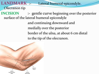 LANDMARK :- Lateral humeral epicondyle.
Olecranon tip
INCISION :- gentle curve beginning over the posterior
surface of the lateral humeral epicondyle
and continuing downward and
medially over the posterior
border of the ulna, at about 6 cm distal
to the tip of the olecranon.
 