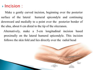 Surgical approaches to the elbow | PPTX