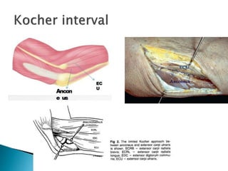 Surgical approaches to the elbow | PPTX