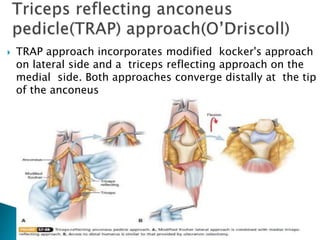 Surgical approaches to the elbow | PPTX